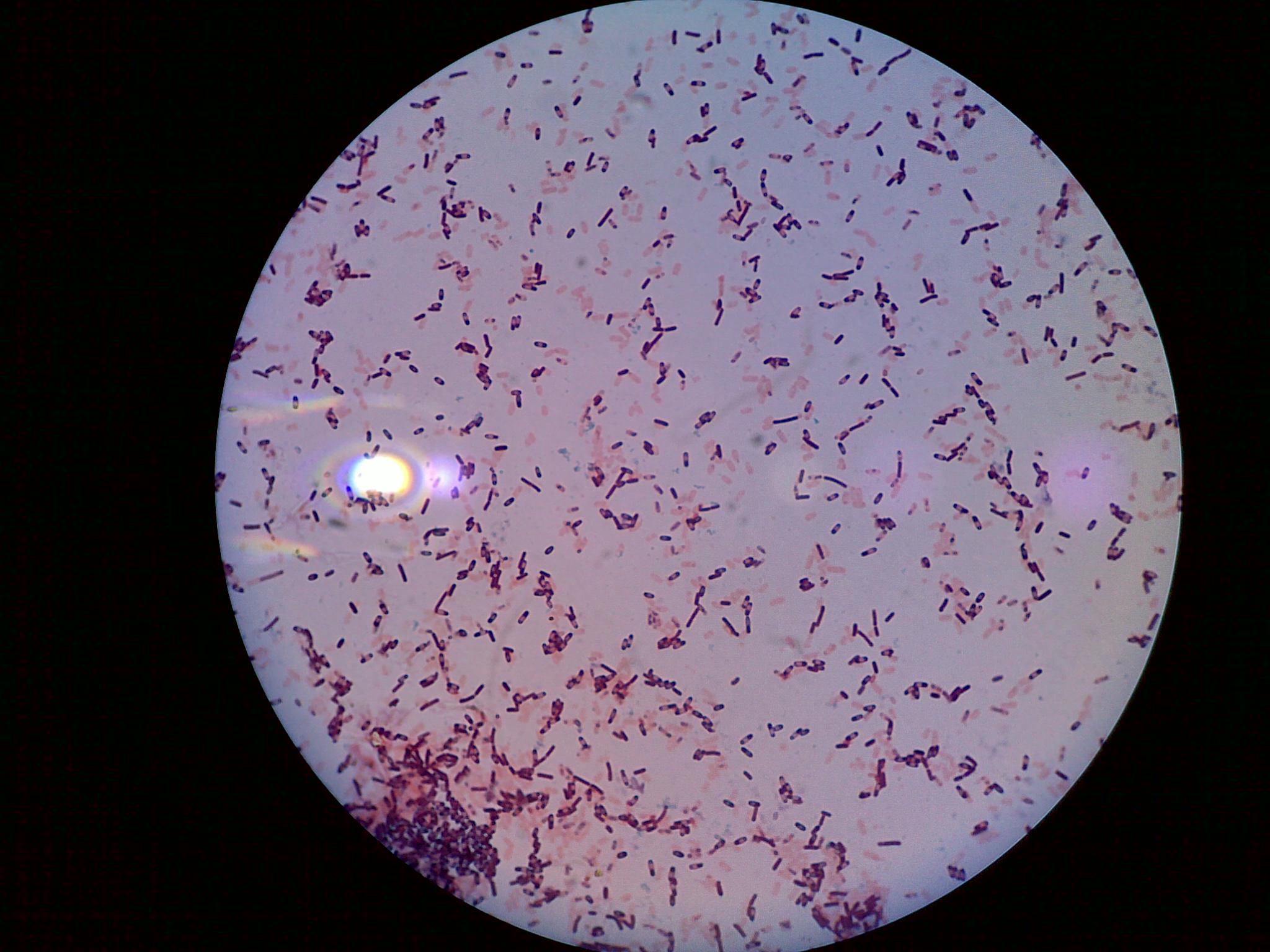 Микропрепарат бактерий. Escherichia coli под микроскопом. Escherichia coli микроскопия. Калибактроз калибактроз. Эшерихии в микроскопе.